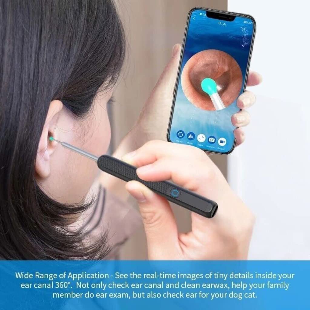 【Vera】Wi-Fi Ear Cleaning Kit Smart Visual Ear Sticks LEDLight 1080P HD load otoscope Ear Cleaner Ear waxremoval tool Suitable for Android iOS phonesEarwax Removal